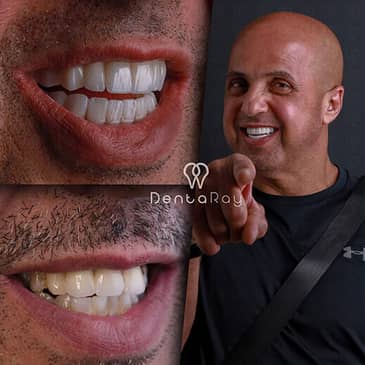 Slider image (9) Dentaray Clinic: luxury Dental Clinic in Istanbul